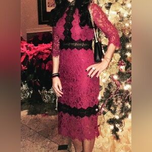 Lace mid length dress